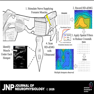 JNP Podcasts: Improving localization and measurements of M-waves using high-density surface electromyography