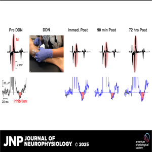 Unlocking the Spine: Exploring the Neurophysiology of Dry Needling