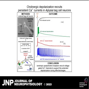 JNP Micro Podcasts:  Acetylcholine receptor and persistent current