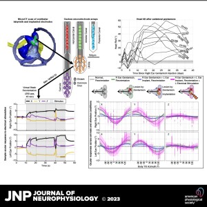 JNP Micro Podcasts ”Four Questions”:  Otolith-ocular reflex after ototoxicity & vestibular implant