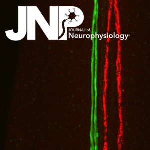 Beyond the sleep-amyloid interactions in Alzheimer's disease pathogenesis