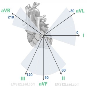 EKG Leads