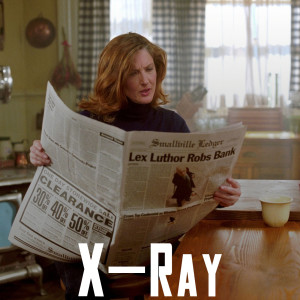 Episode 4 - 1×04 X-Ray