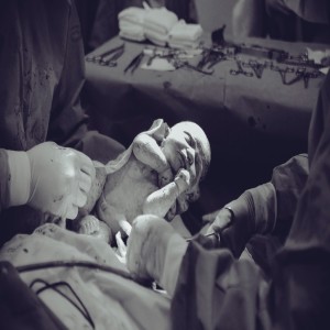 31. Din operation - KEJSARSNITT