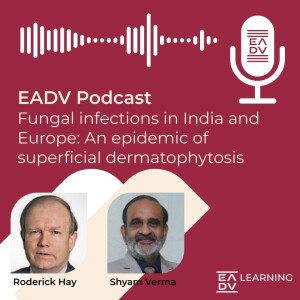 E78: Fungal infections in India and Europe: An epidemic of superficial dermatophytosis