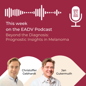 E138: Beyond the Diagnosis: Prognostic Insights in Melanoma