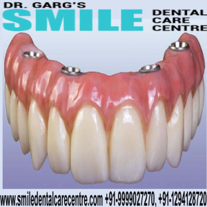 Best Dental Clinic in Faridabad for Advanced Oral Treatments at Reasonable Prices