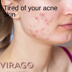 Consult for skin problems - Virago Skin consultation