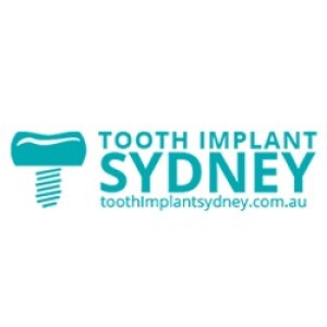 How Important is Dental Implants For Your Oral & Overall Health