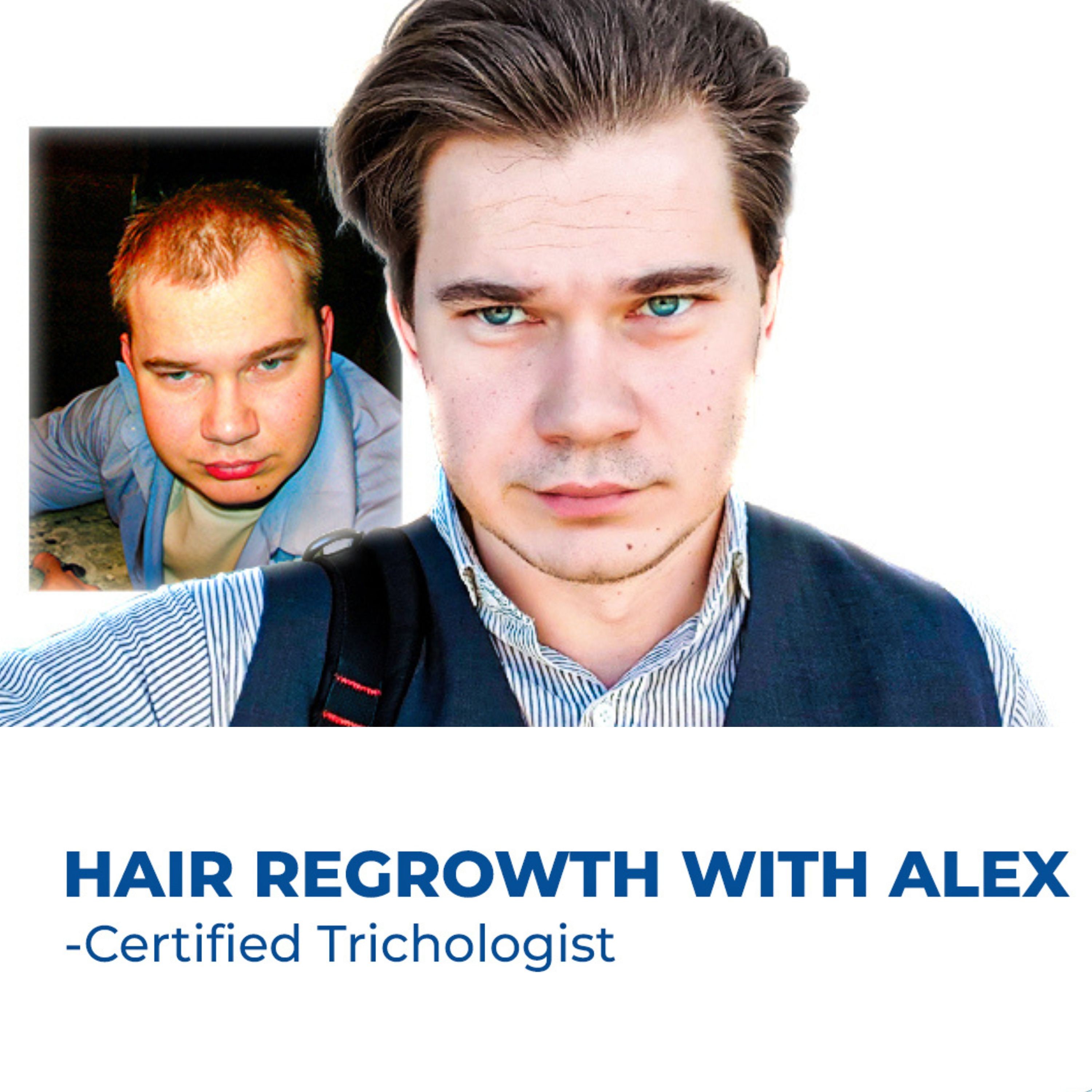 HAIR REGROWTH WITH ALEX