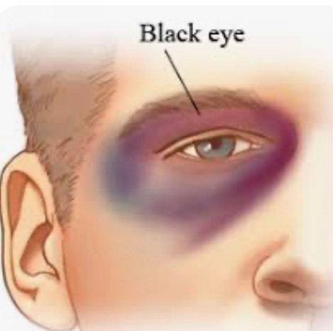 Eye Doc Fal