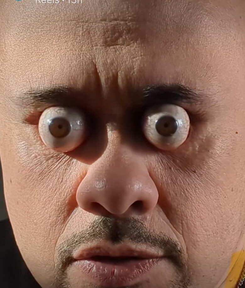 Eye Doc Fal