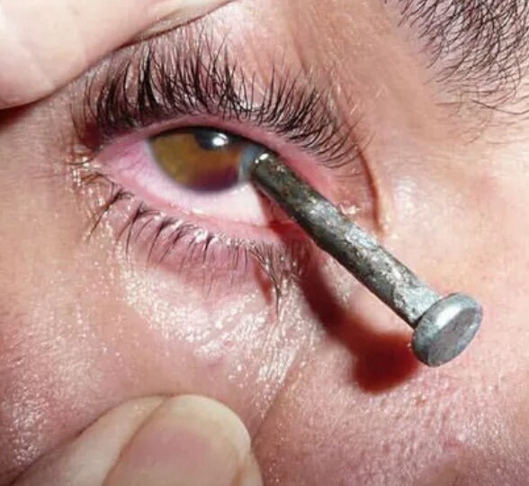 Eye Doc Fal
