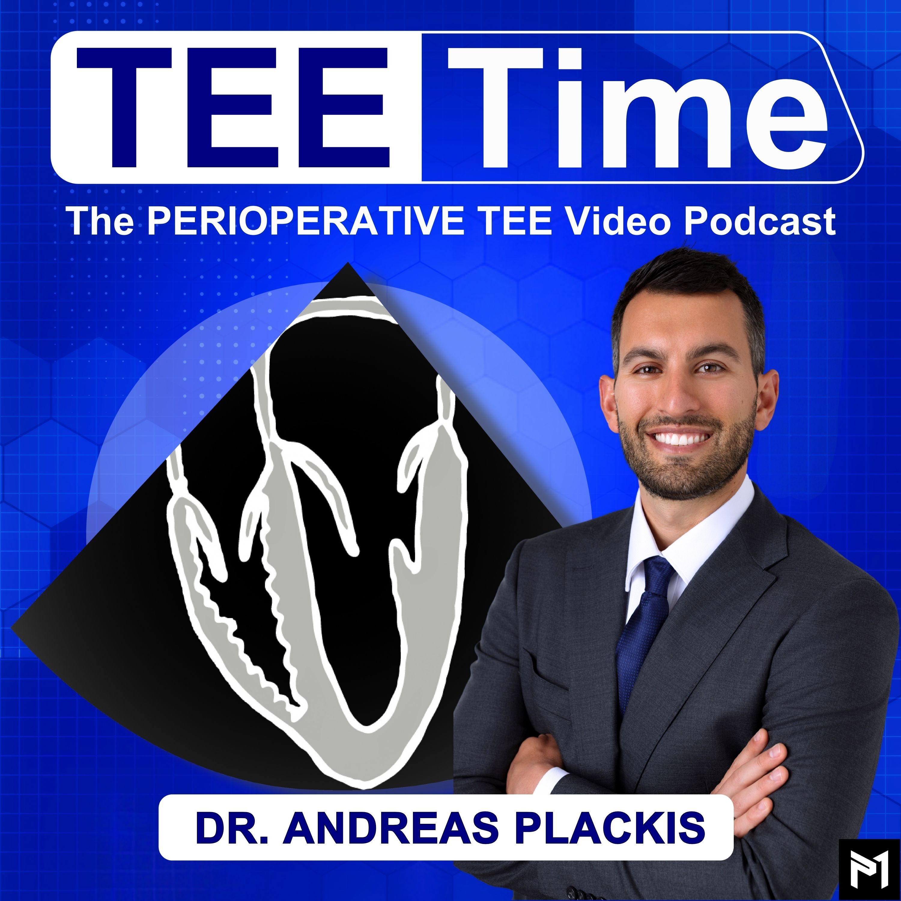 TEE Time: The Perioperative TEE Video Podcast