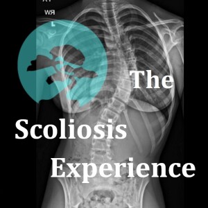The Scoliosis Experience